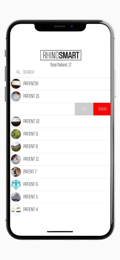 Rhino Smart - Smartphone display of the Rhino Smart app showing a list of archived patient procedure sheets