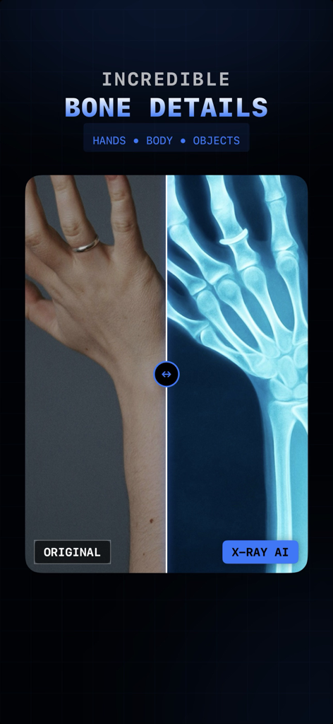 Before and after comparison of a hand using AI X-ray filter