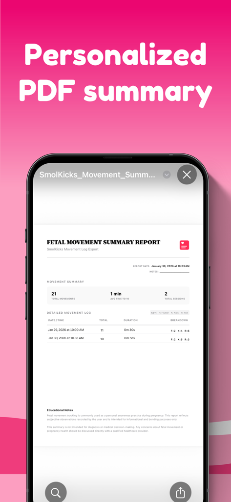 Un informe resumen de movimientos fetales personalizado que muestra el recuento de patadas y los registros de sesiones en la aplicación SmolKicks