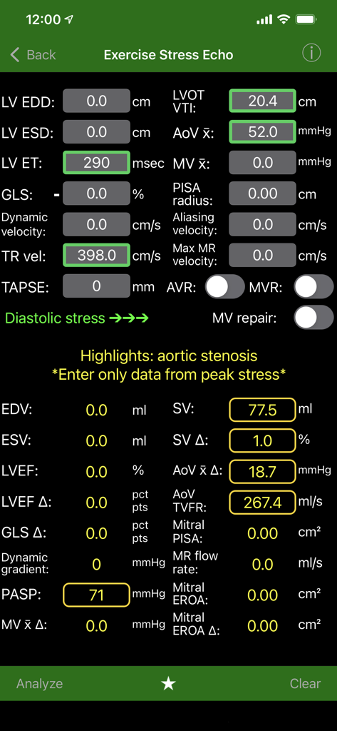 EchoLabアプリインターフェイス、運動負荷心エコー心血管計算および臨床測定値を表示