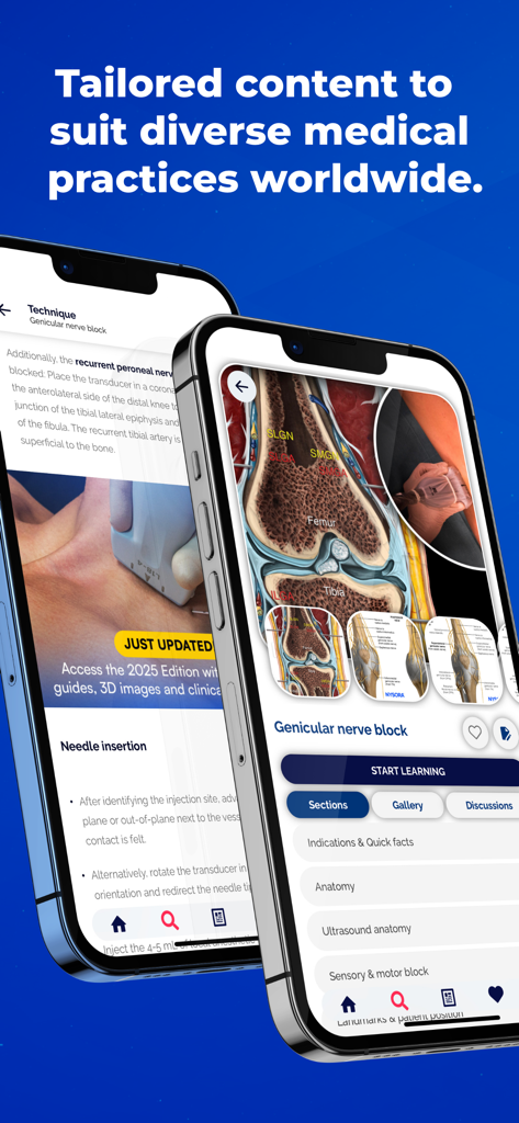 NYSORA Nerve Blocks - Two iPhones displaying the NYSORA Nerve Blocks app interface with anatomy illustrations and genicular nerve block techniques