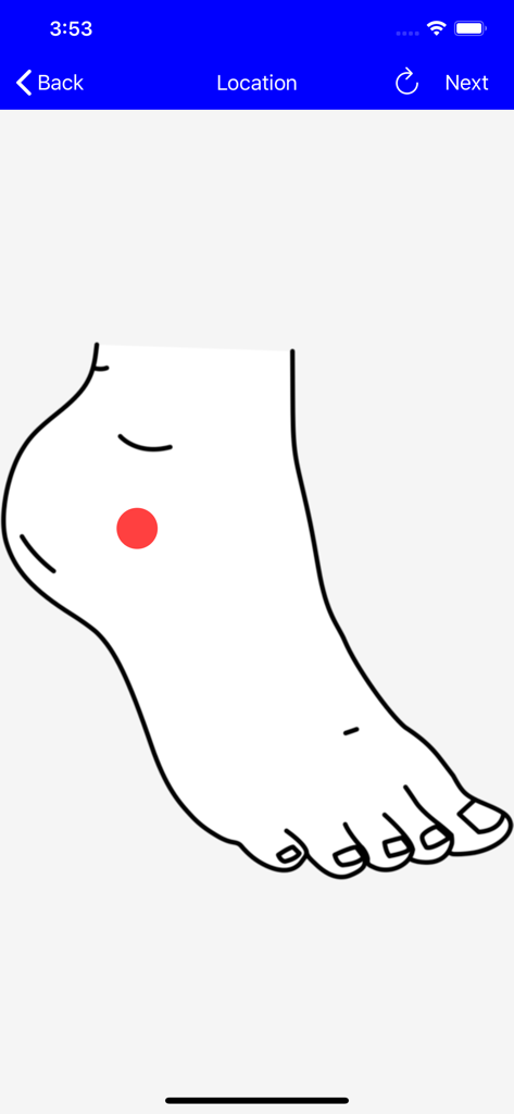 A screen for selecting wound location on a foot diagram with a red dot marker
