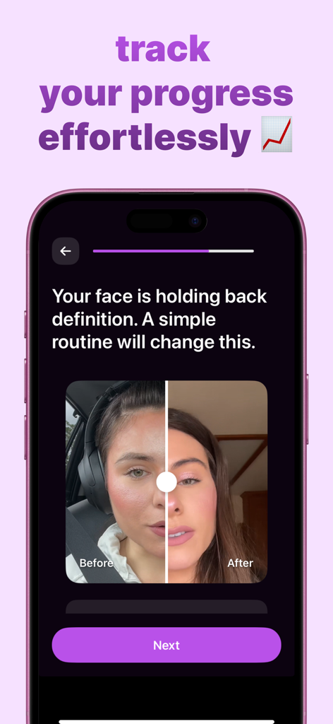 Pantalla de la aplicación Debloat AI que muestra una comparación facial de antes y después para seguir los resultados de desinflamación.
