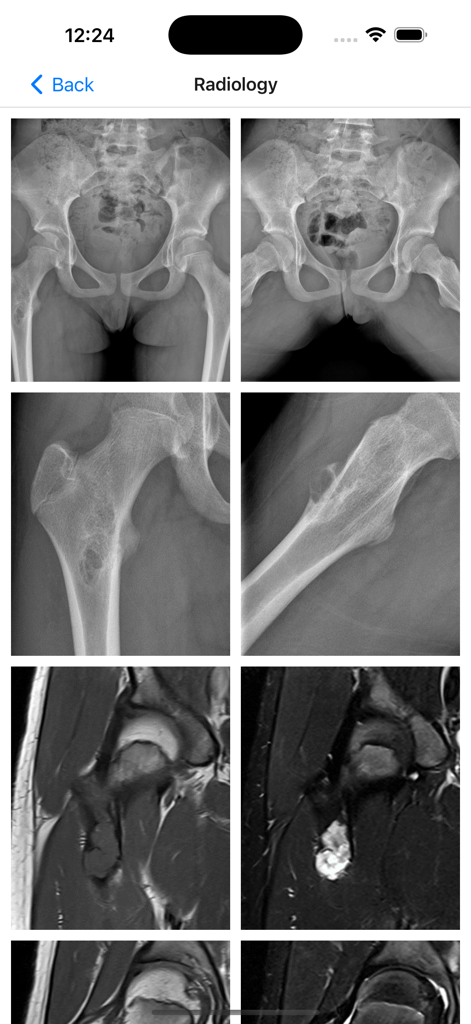 BoSTT - Radiology screen showing multiple X-ray and MRI scans for medical diagnosis