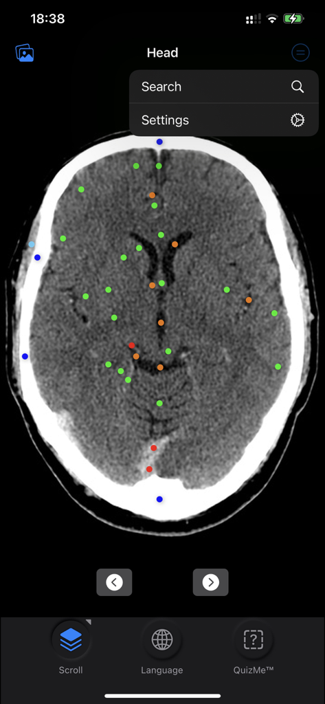 CT Anatomy - Axial CT scan of a human head with color coded anatomical markers in the CT Anatomy app.