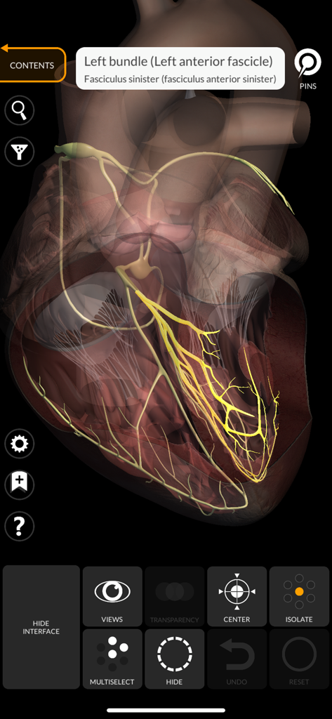 Detailed 3D model of a human heart with the left bundle branch highlighted in yellow.