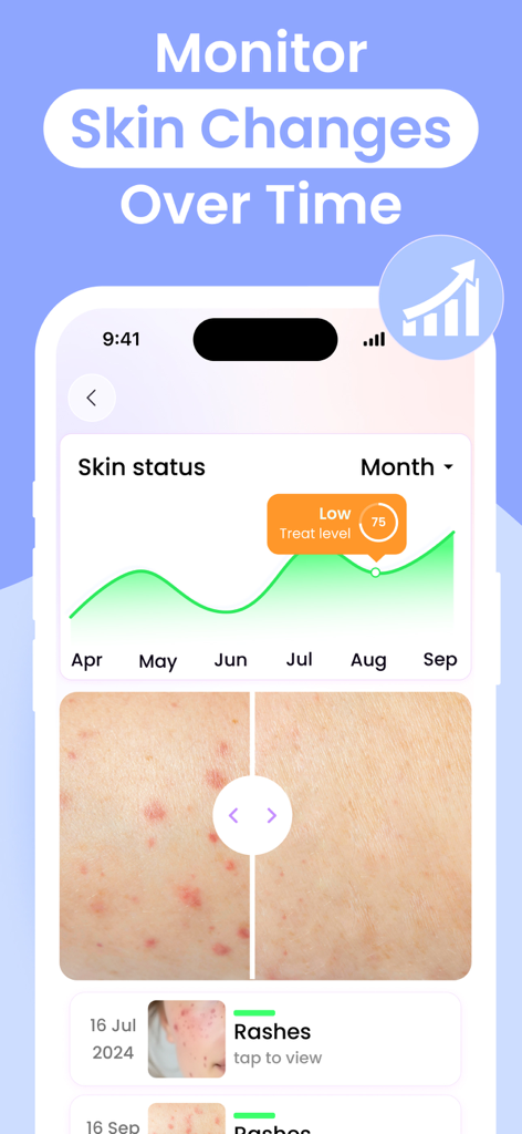 Interfaz de la aplicación móvil que muestra un gráfico del estado de la piel y una comparación fotográfica lado a lado de una erupción cutánea a lo largo del tiempo.