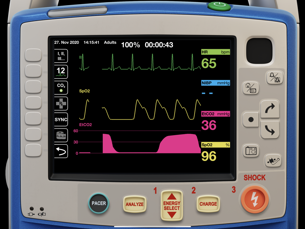 qubeX application interface simulating a Zoll Medical X Series monitor with vital signs and waveforms