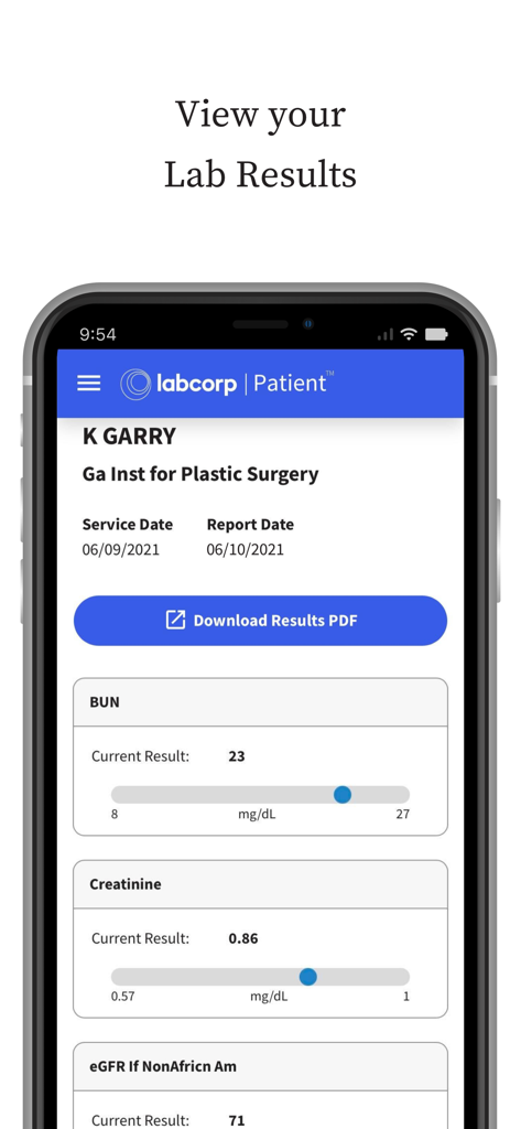 Una pantalla de teléfono inteligente que muestra los resultados de pruebas de laboratorio personales con métricas de química sanguínea en la aplicación Labcorp Paciente