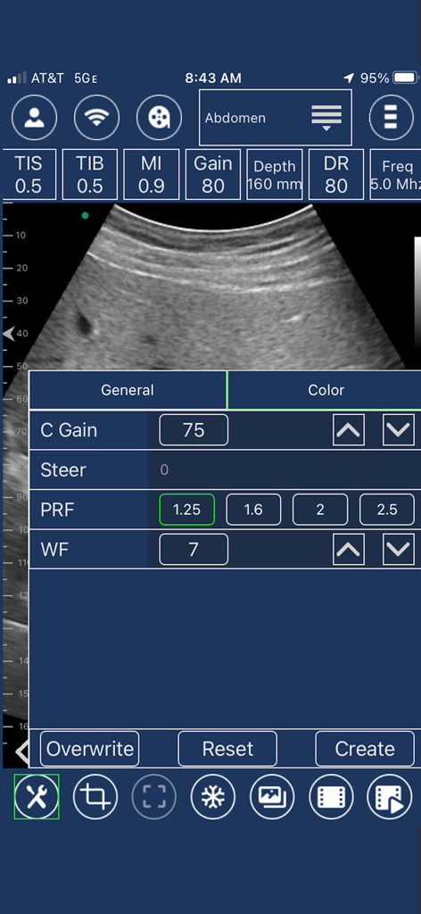 EdgeLife - Interfaz de usuario de la aplicación EdgeLife que muestra un escaneo de ultrasonido abdominal con configuraciones de Doppler color y parámetros técnicos.