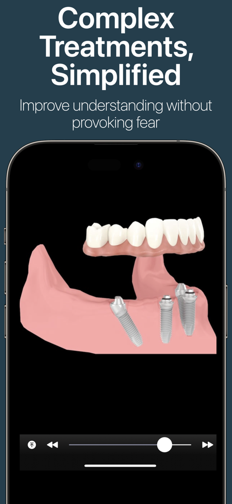 3D visualization of dental implants and a bridge on a lower jaw within the DDS GP app