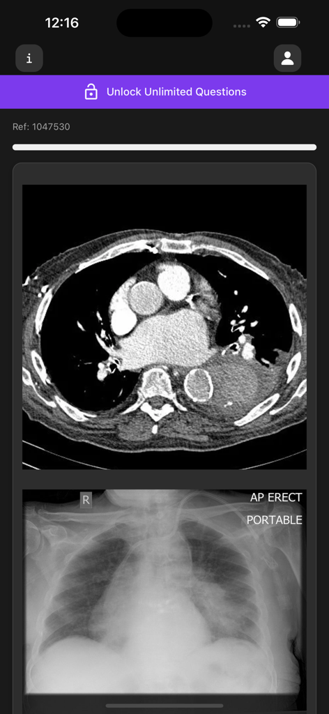 Screenshot of the Basic Radiology app interface featuring a chest CT scan and an AP erect portable chest X-ray