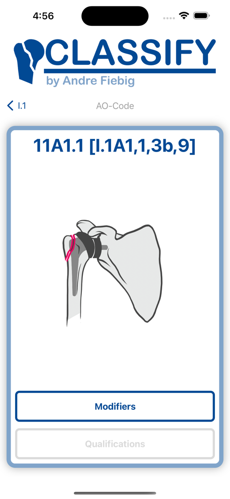 Classify - FractureCode - Medical diagram of a shoulder fracture with AO classification code 11A1.1 in the Classify app.