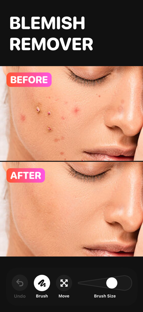 Erase Objects: Blemish Remover - Before and after comparison of facial skin retouching using the Erase Objects app blemish remover tool.