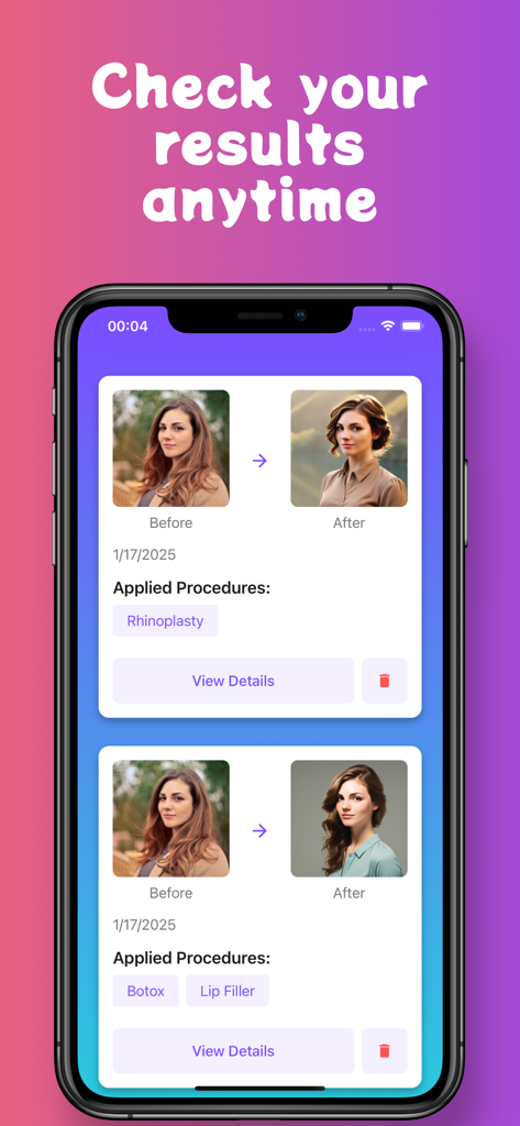 Pody Plastic Surgery Simulator - Before and after AI plastic surgery simulations for rhinoplasty and botox in the Pody app