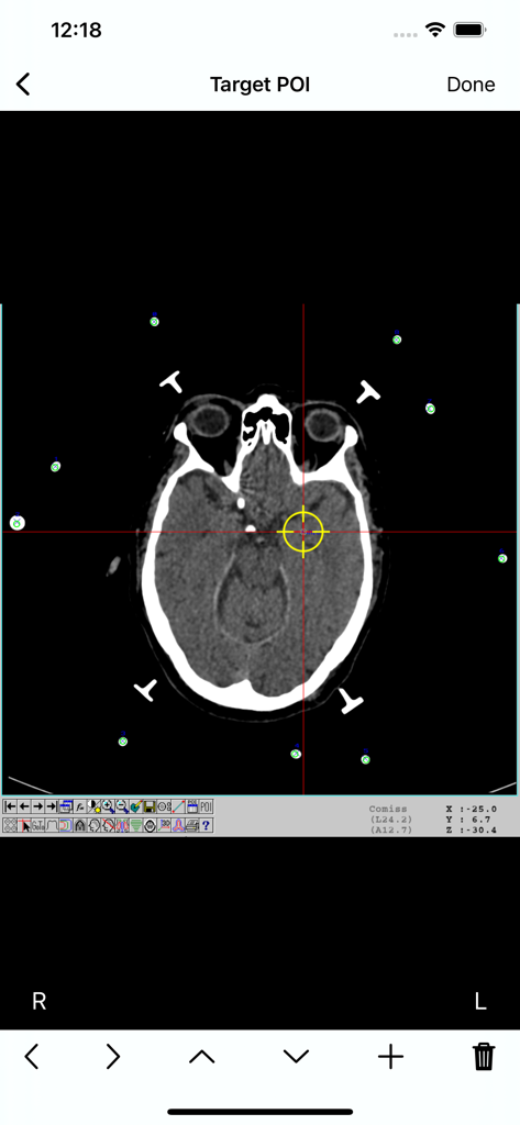 CheckBRW app interface showing a target point selection on a brain CT scan for stereotactic surgery planning