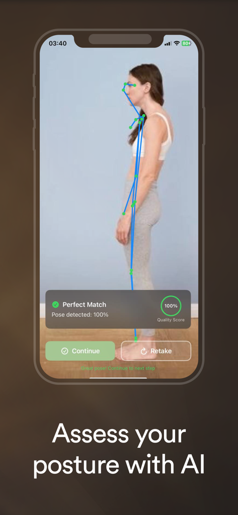 UpWise - Fix Posture Now - Smartphone screen displaying an AI posture scan with anatomical alignment markers and a quality score