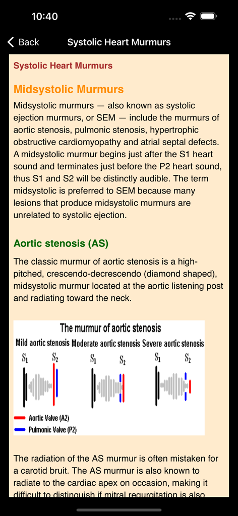 Heart Sounds and Lung Sounds - Educational screen explaining midsystolic murmurs and aortic stenosis with a diagram of murmur intensity levels