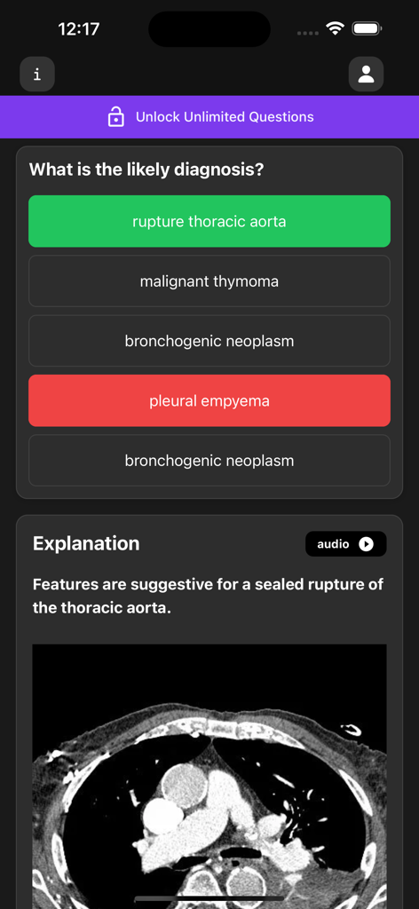 A medical quiz question in the Basic Radiology app showing a CT scan image and a correct diagnosis for a thoracic aorta rupture.