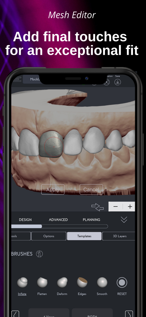 SmileFy TNG - Interfaz del Editor de Malla de SmileFy TNG que muestra herramientas de edición de modelos dentales 3D