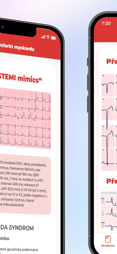 Interfaz móvil de una aplicación de aprendizaje de EKG que muestra tiras de electrocardiograma y notas de teoría clínica