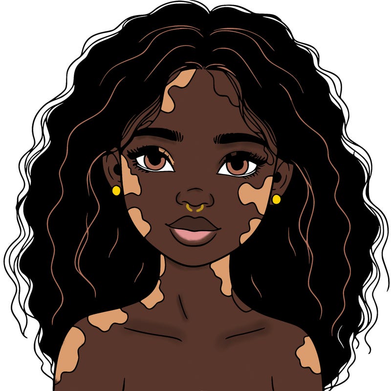beautiful black girl with vitiligo