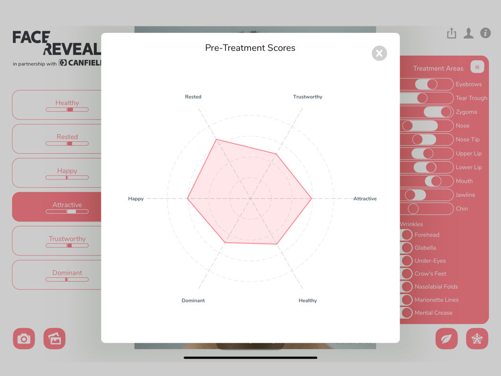 FaceReveal app showing pre-treatment scores on a radar chart for aesthetic consultation