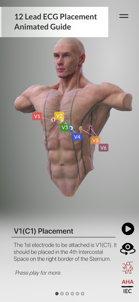 3D anatomical model showing V1 lead placement on the human chest