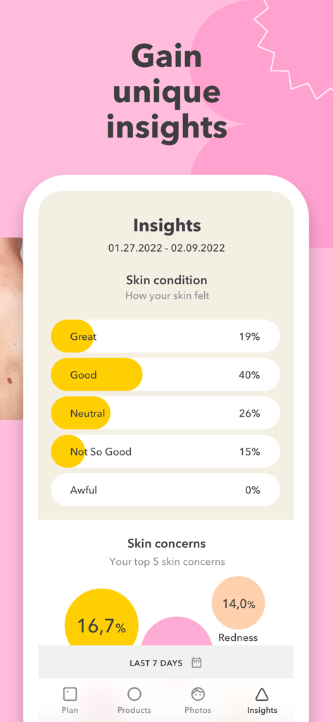 Skincare Routine: BasicBeauty - BasicBeauty app screen showing skin condition statistics and top skin concerns analytics.