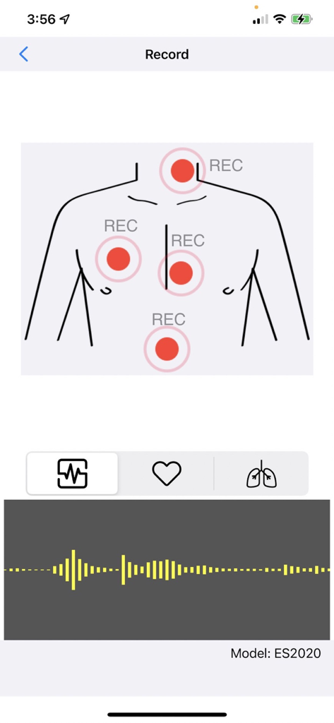 Smart Stethoscope - Smart Stethoscope app recording screen showing medical diagrams of torso recording points and live audio waveform