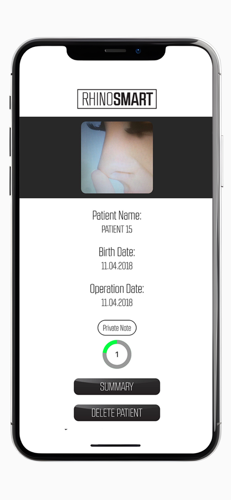 Rhino Smart - Rhino Smart app interface displaying a patient surgical record with nose profile image.