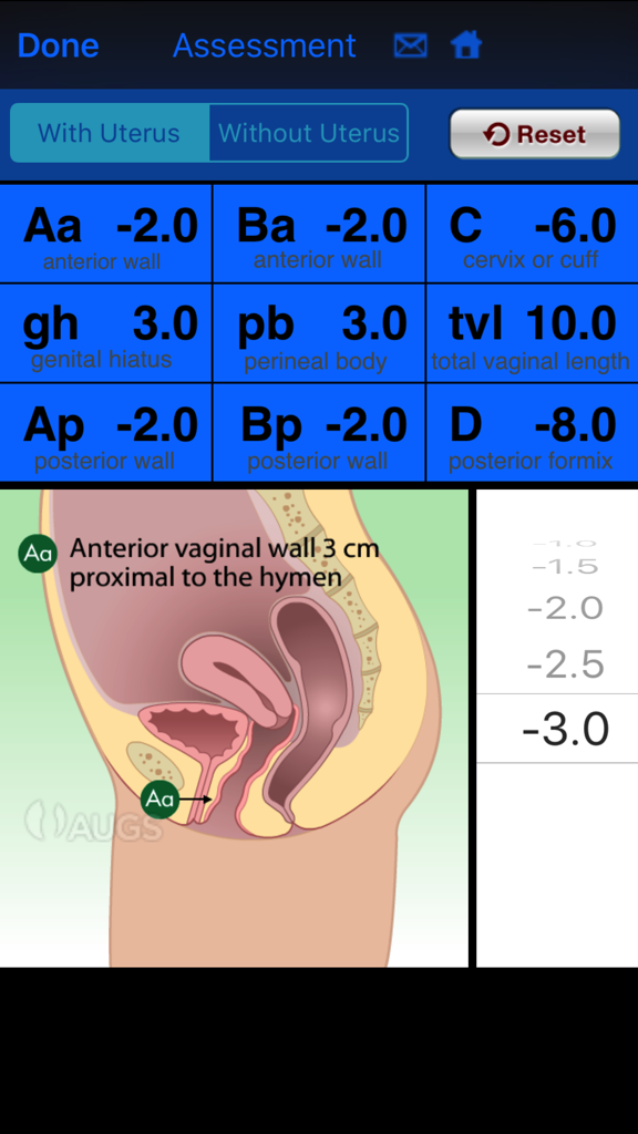A screenshot of the AUGS POP-Q app interface featuring a 3x3 assessment grid and a pelvic anatomy diagram.