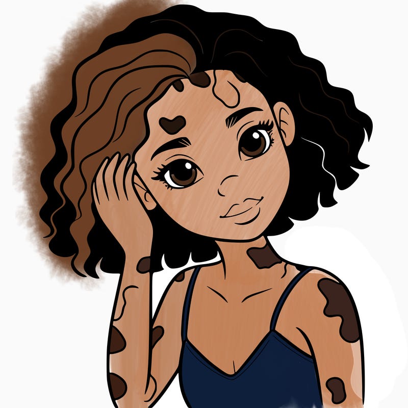 vitiligo black girl