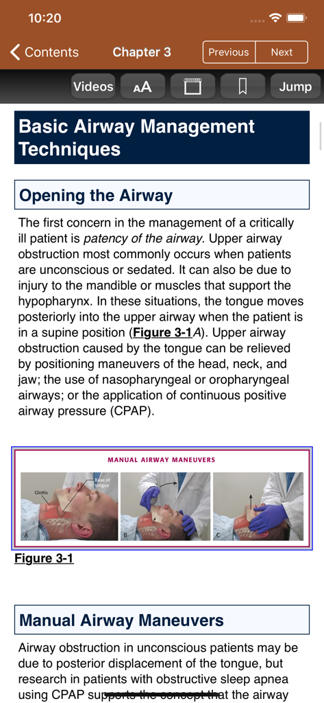 Medical procedure guide for opening the airway in the Roberts and Hedges emergency medicine app