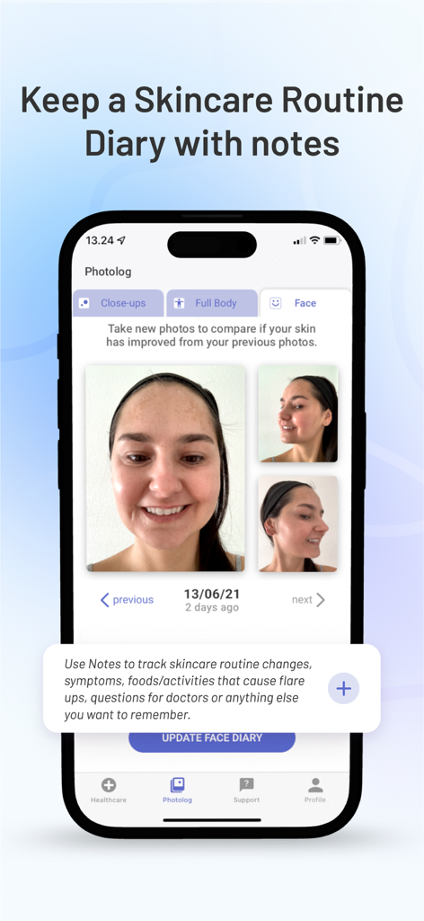 Miiskin: Rx Dermatology Visits - Miiskin app interface showing face photo tracking and skincare diary notes