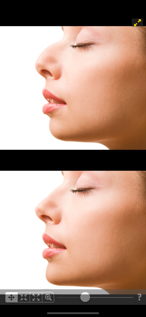 Confronto prima e dopo di un profilo femminile che mostra i risultati del rimodellamento del naso nell'app Editor foto viso e corpo