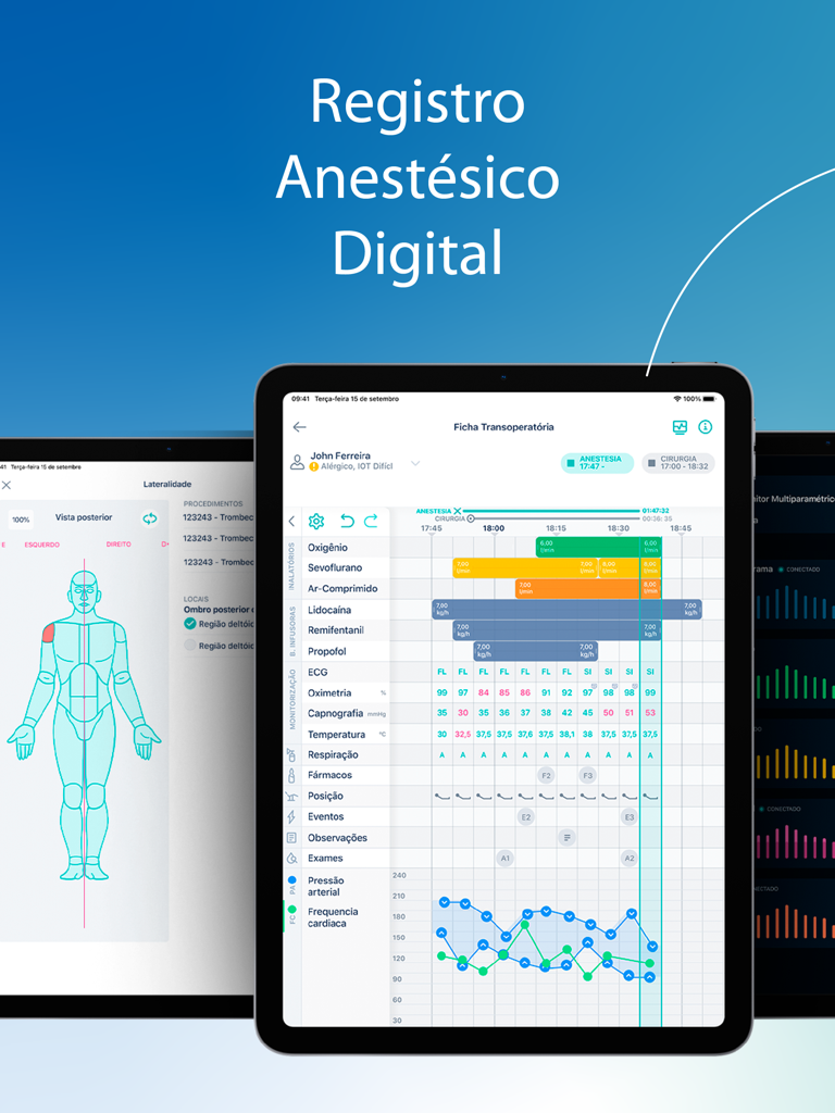 AxReg - AxReg digital anesthesia record app on iPad showing real-time intraoperative medical monitoring and drug administration charts