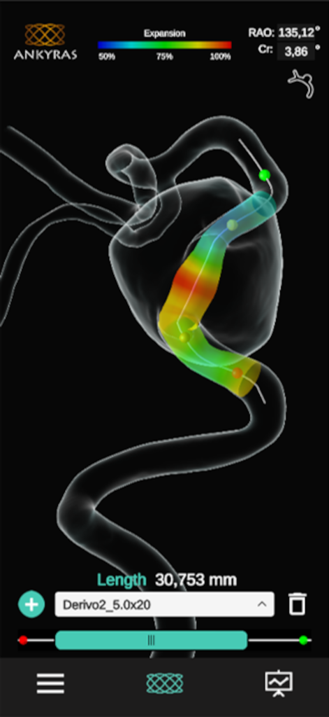 Ankyras - 3D visualization of a flow diverter stent expansion within a cerebral artery aneurysm using the Ankyras medical planning tool