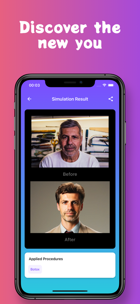 Pody Plastic Surgery Simulator - Side by side before and after botox simulation result for a male user on Pody Plastic Surgery Simulator app