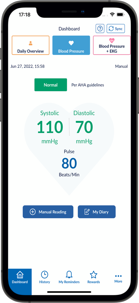 OMRON connect app dashboard showing normal blood pressure and pulse readings