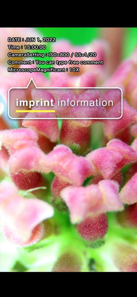 i-NTER SHOT2 for microscope - Microscope photograph showing the imprint information feature with technical camera settings and custom comments