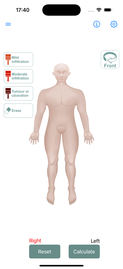 Cutaneous Lymphoma Tools - Interactive human mannequin for mSWAT skin assessment and lesion mapping in the Cutaneous Lymphoma Tools app