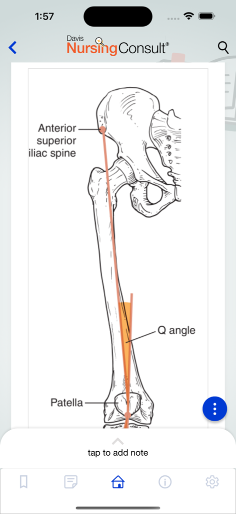 Diagrama anatómico de una pierna que muestra el ángulo Q de la rótula y la espina ilíaca anterosuperior.