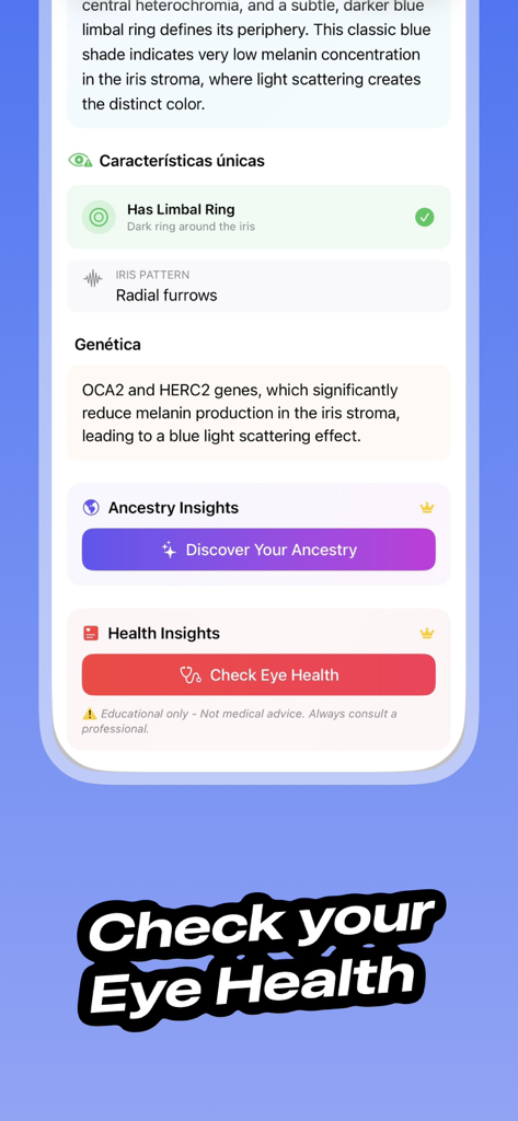 Eye Color Identifier - EyeScan - Reference App | MWM