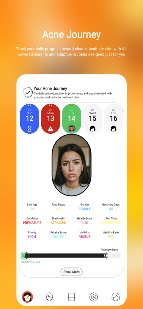 Bildschirm der Acnetic-App, der den personalisierten Akne-Reise-Fortschritt und KI-Hautanalysemetriken anzeigt.