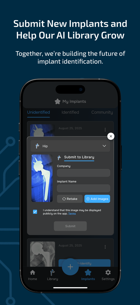 Implant Identifier - A mobile interface for the Implant Identifier app showing a form to submit a new hip implant X-ray to the AI database.