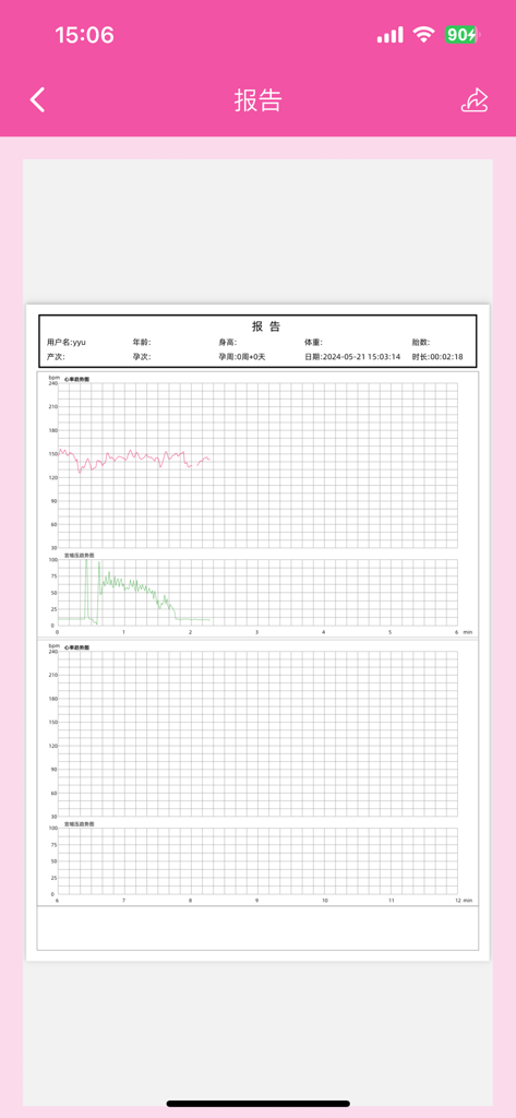 康泰优贝 - Un informe detallado de monitoreo fetal dentro de la aplicación Contec Baby con gráficos de frecuencia cardíaca y presión uterina.