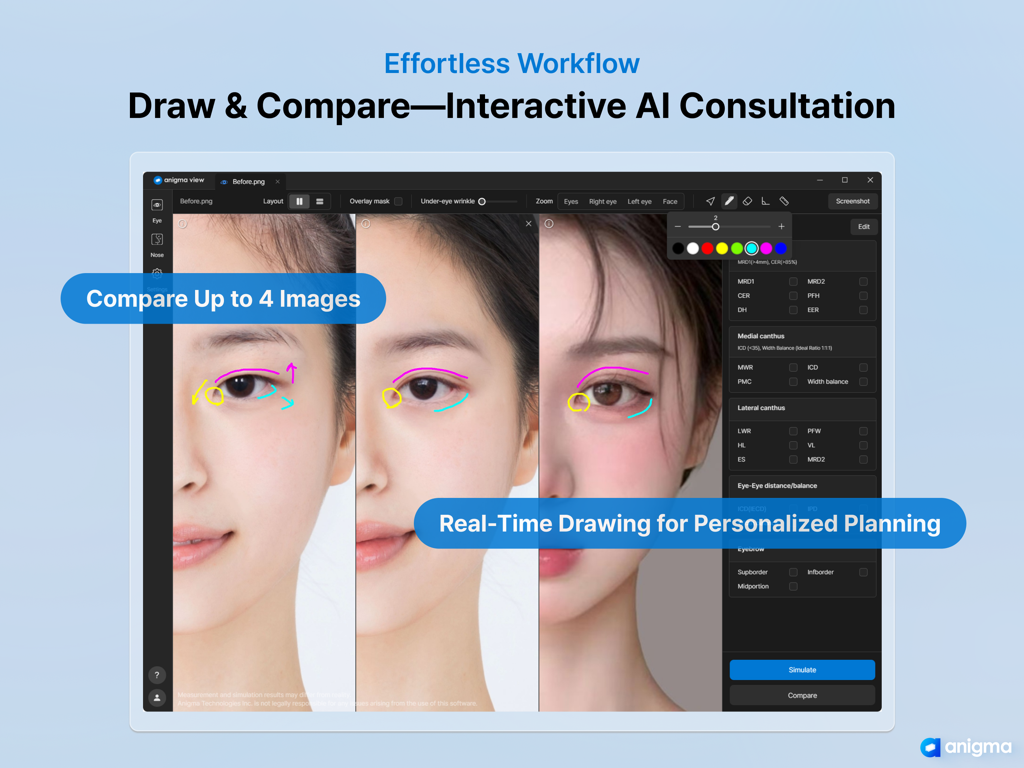 Anigma View - Anigma View interface showing real time drawing and image comparison for personalized AI medical consultations