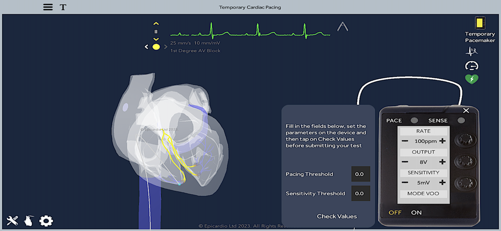 Temporary Cardiac Pacing - Interfaz de la aplicación de Estimulación Cardíaca Temporal que muestra un modelo 3D del corazón y un dispositivo de marcapasos virtual.