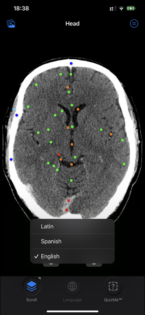CT Anatomy - Axial head CT scan with color coded pins and language selection menu for anatomical nomenclature
